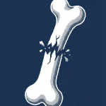 bone smashing ados — illustration