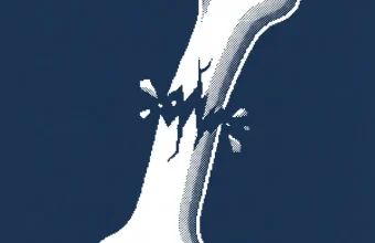 bone smashing ados — illustration