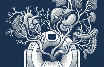 intrasense — illustration
